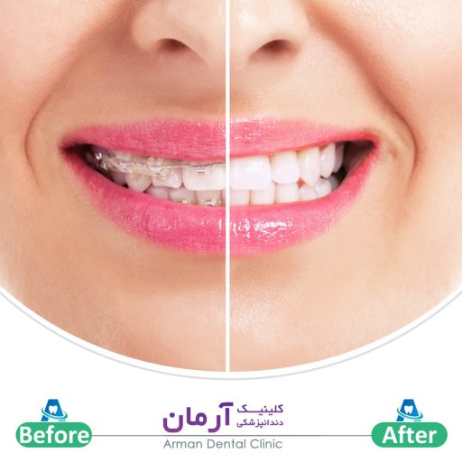 کلینیک ارتودنسی دندان در شیراز